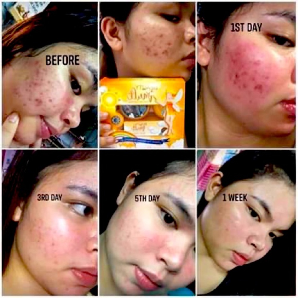 Beauty vault rejuvenating set